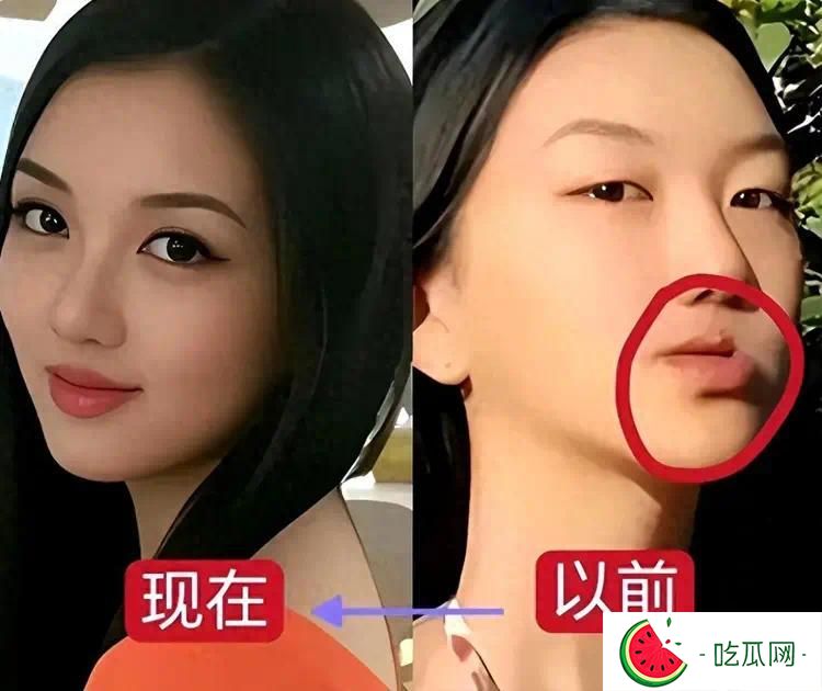 去掉兔唇后的李嫣驚為天人，果然，有王菲李亞鵬當爸媽就是不一樣